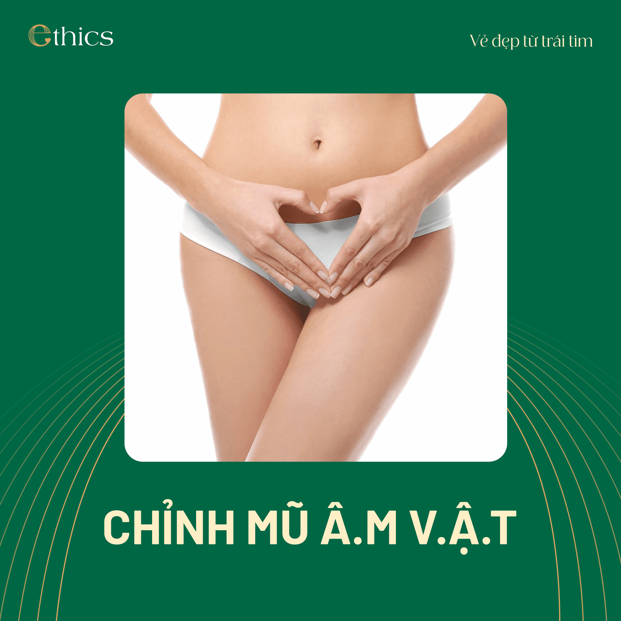 ការបង្កើតរូបរាងគម្របក្លីតូរីស