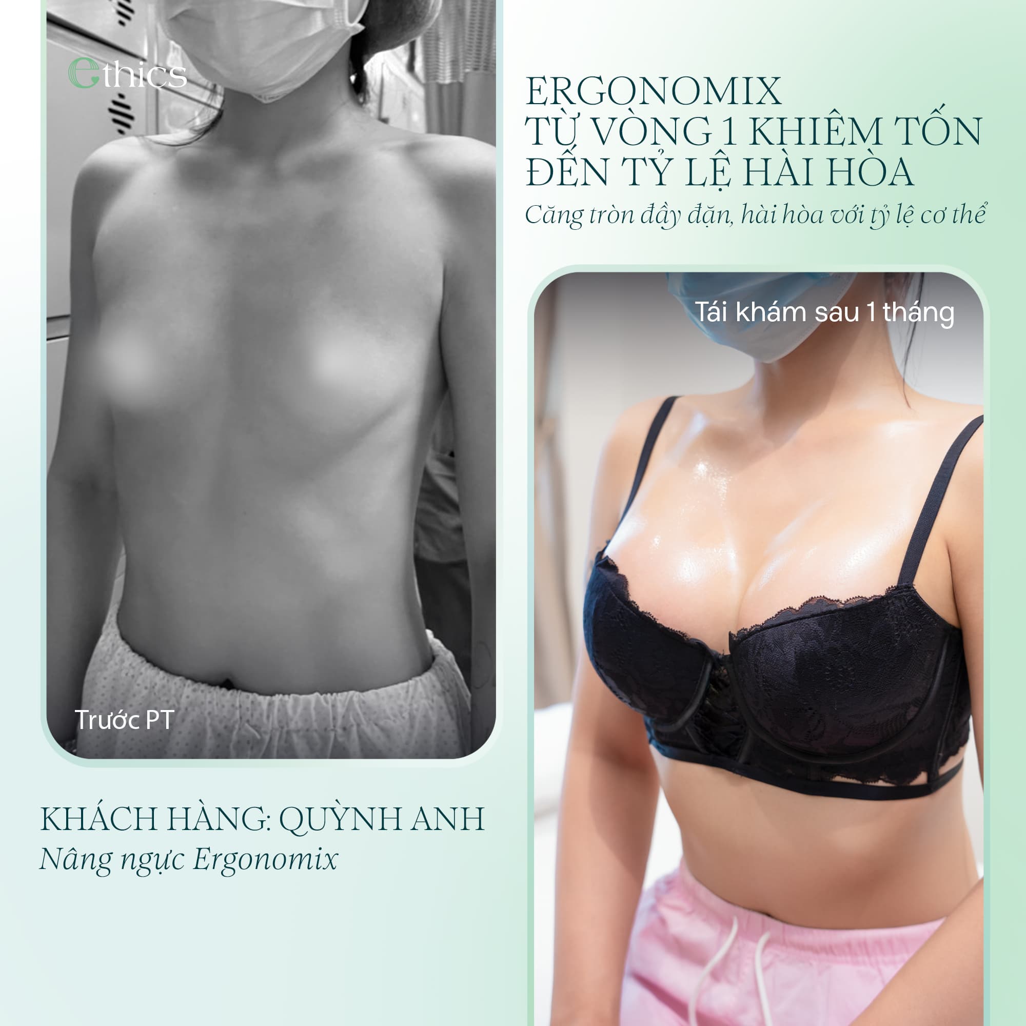 កែទ្រូង
