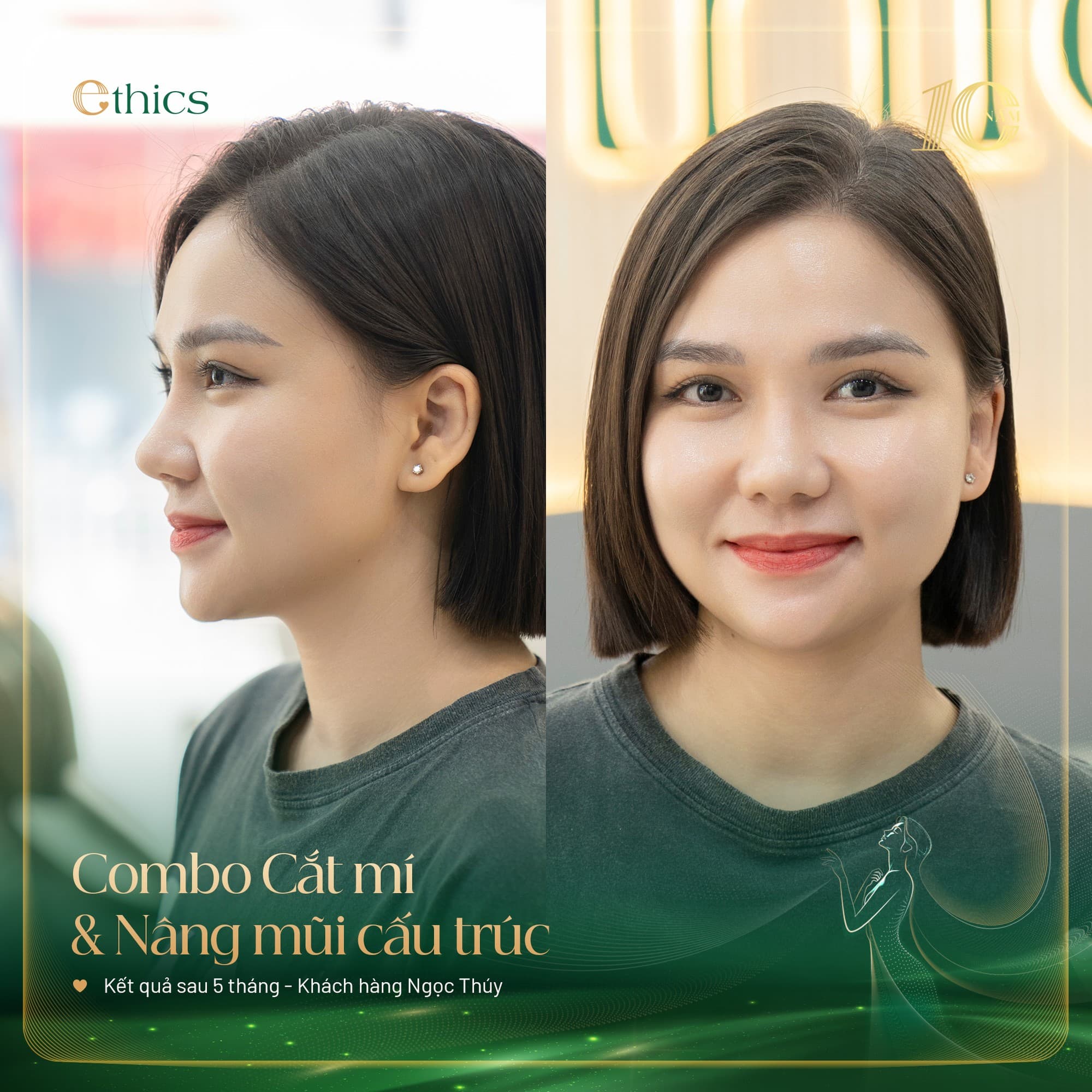 ត្រាសែត លើកឡើង