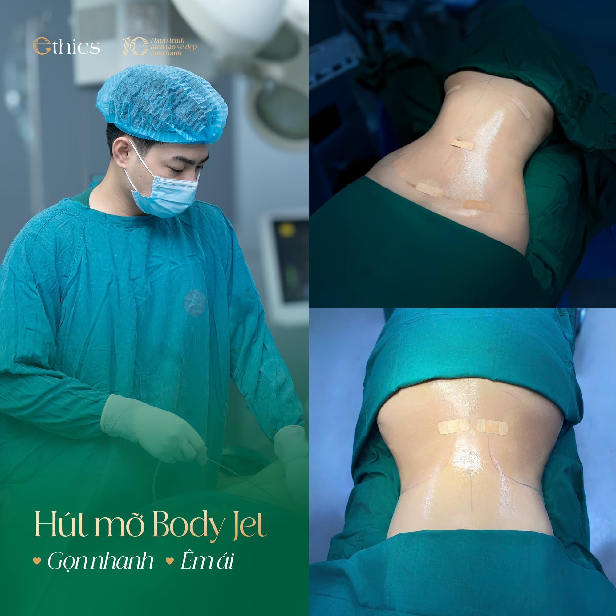 ការបូមដាសប្រភេទ Slim Fit