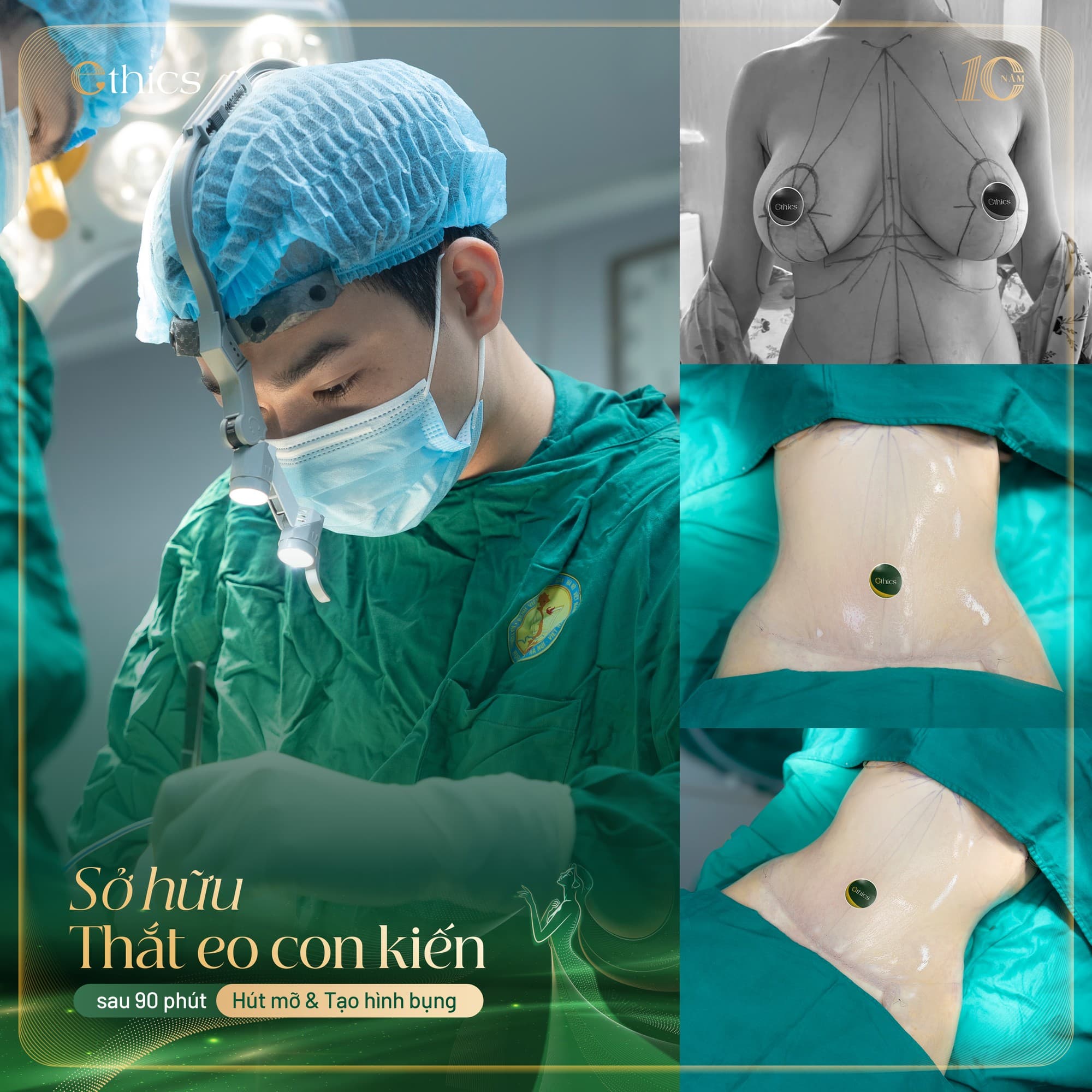 រាងកាយទាំងមូល – ច្រកដែលតូចជាង ឬស្មើនឹង 80 សង់ទីម៉ែត្រ