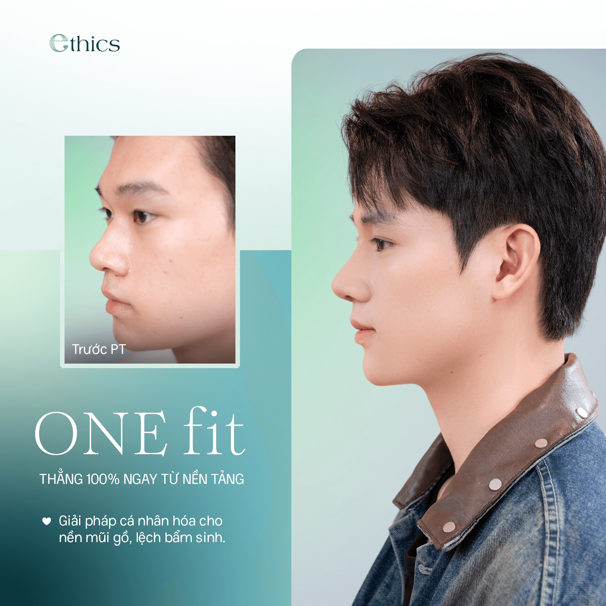 ការកែច្នៃច្រមុះ OneFit