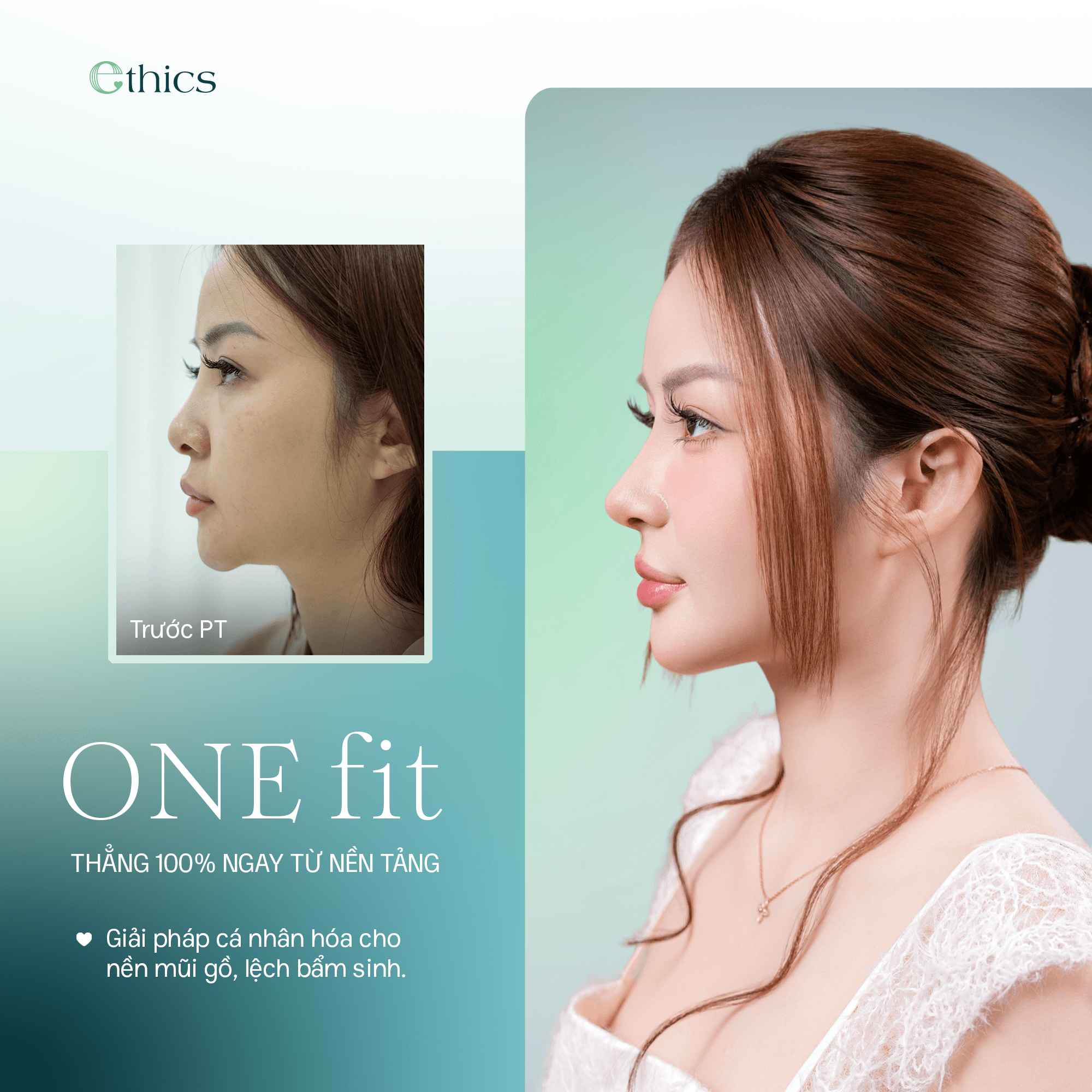 ការកែច្នៃច្រមុះ OneFit Premium