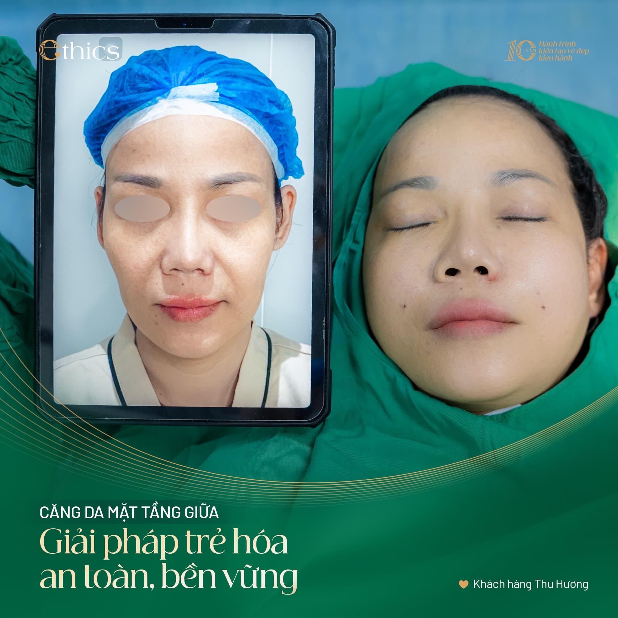 ការកាត់បន្ថយឆ្អឹងគី និងការតឹងរឹងនៃស្បែក